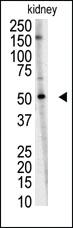 Anti-RNF216 Rabbit Polyclonal Antibody