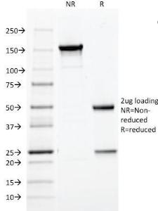 SDS-PAGE analysis of Anti-HPV16 L1 Antibody [CAMVIR-1] under non-reduced and reduced conditions; showing intact IgG and intact heavy and light chains, respectively. SDS-PAGE analysis confirms the integrity and purity of the Antibody