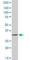 Anti-FBP2 Rabbit Polyclonal Antibody