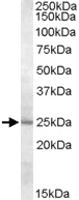 Anti-MTHFS Goat Polyclonal Antibody