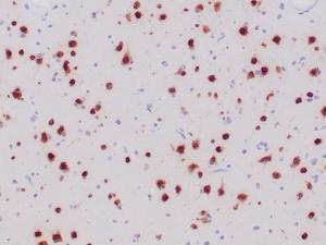 Immunohistochemical analysis of formalin-fixed, paraffin-embedded human ganglioma tissue using Anti-NeuN Antibody [NeuN/6694R]