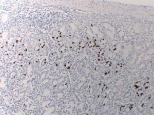 Immunohistochemical analysis of paraffin-embedded human Stomach using Anti-Gastrin Antibody