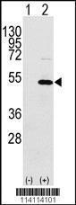 Anti-YBX1 Rabbit Polyclonal Antibody