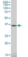 Anti-PDLIM1 Mouse Monoclonal Antibody [clone: 2D4]