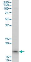 Anti-TOMM22 Mouse Polyclonal Antibody