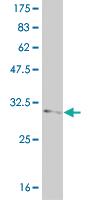 Anti-FOXL1 Mouse Monoclonal Antibody [clone: 2F6]