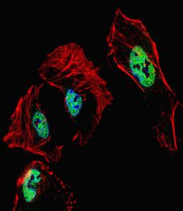 Anti-RARB Rabbit Polyclonal Antibody