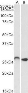 Anti-HOXC6 Antibody (A82696) (0.01µg/ml) staining of Mouse (A) and Rat (B) Brain lysates (35µg protein in RIPA buffer). Primary incubation was 1 hour. Detected by chemiluminescence.