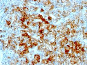 Antibody anti-CADHERIN 16 SPM594 100 µg