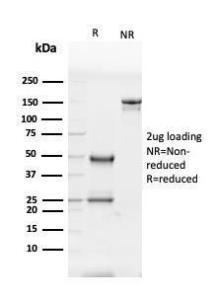 SDS-PAGE analysis of Anti-Glycoprotein 2 Antibody [GP2/3416] under non-reduced and reduced conditions; showing intact IgG and intact heavy and light chains, respectively. SDS-PAGE analysis confirms the integrity and purity of the antibody.