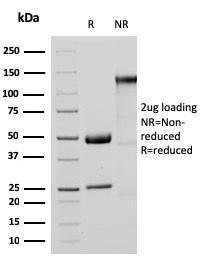 SDS-PAGE analysis of Anti-MTAP Antibody [MTAP/3137R] under non-reduced and reduced conditions; showing intact IgG and intact heavy and light chains, respectively. SDS-PAGE analysis confirms the integrity and purity of the antibody.