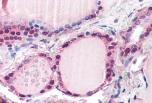 Anti-FBXL3 Antibody (A84241) (5 µg/ml) staining of paraffin embedded Human Thyroid. Steamed antigen retrieval with citrate buffer pH 6, AP-staining