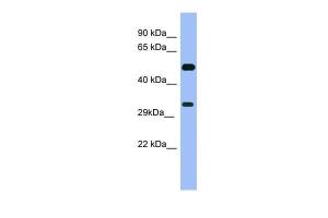 Anti-MAGEB1 Rabbit Polyclonal Antibody