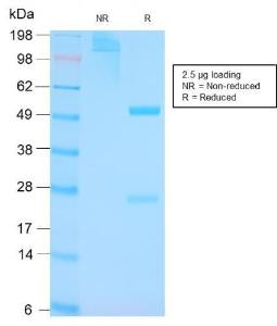 SDS-PAGE analysis of Anti-p53 Antibody [TP53/3156R] under non-reduced and reduced conditions; showing intact IgG and intact heavy and light chains, respectively. SDS-PAGE analysis confirms the integrity and purity of the antibody.