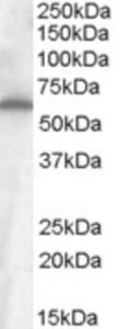 EB08356 (1 µg/ml) staining of Small Intestine (Ileum) cell lysate (35 µg protein in RIPA buffer).  Primary incubation was 1 hour.  Detected by chemiluminescence.