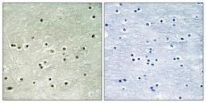 Immunohistochemical analysis of paraffin-embedded human brain using Anti-MCM4 (phospho Ser54) Antibody 1:100 (4°C overnight). The right hand panel represents a negative control, where the antibody was pre-incubated with the immunising peptide.