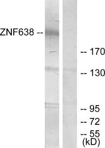 Western blot analysis of lysates from HepG2 cells, treated with serum 20% 15' using Anti-ZNF638 Antibody. The right hand lane represents a negative control, where the antibody is blocked by the immunising peptide