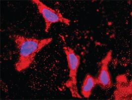 Anti-CCNE1 + CDKN1B Antibody Pair