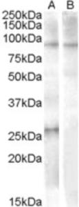 EB08357 (1 µg/ml) staining of Human Heart lysate (35 µg protein in RIPA buffer) with (B) and without (A) blocking with the immunising peptide.  Primary incubation was 1 hour.  Detected by chemiluminescence.