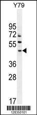 Anti-LACE1 Rabbit Polyclonal Antibody