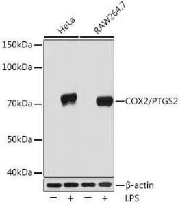 Western blot analysis of extracts of various cell lines, using Anti-COX2 Antibody [ARC0800] (A305988) at 1:1,000 dilution. The secondary antibody was Goat Anti-Rabbit IgG H&L Antibody (HRP) at 1:10,000 dilution.