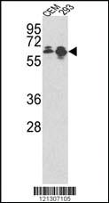 Anti-MCCC2 Rabbit Polyclonal Antibody