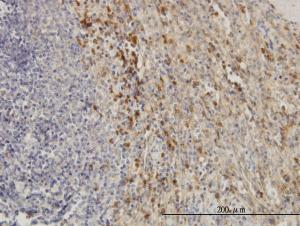 Anti-TIMP2 Mouse Monoclonal Antibody [clone: 5B11]