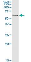 Anti-CAT Polyclonal Antibody Pair