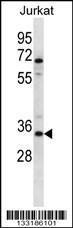 Anti-OR2G3 Rabbit Polyclonal Antibody (AP (Alkaline Phosphatase))