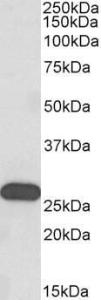 Anti-HOXC6 Antibody (A82696) (0.3µg/ml) staining of Human Olfactory bulb lysate (35µg protein in RIPA buffer). Primary incubation was 1 hour. Detected by chemiluminescence.