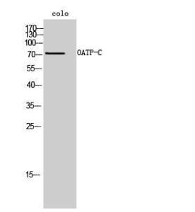 Western blot analysis of colo cells using Anti-SLCO1B1 Antibody