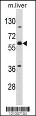 Anti-MCCC2 Rabbit Polyclonal Antibody