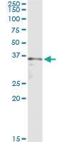 Anti-SGOL1 Antibody Pair