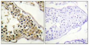 Immunohistochemical analysis of paraffin-embedded human testis using Anti-ITK (phospho Tyr512) Antibody 1:100 (4°C overnight). The right hand panel represents a negative control, where the antibody was pre-incubated with the immunising peptide.