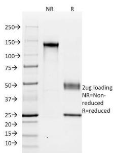 Antibody anti-CADHERIN 16 SPM594 100 µg