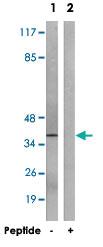 Anti-SLC16A13 Rabbit Polyclonal Antibody