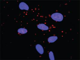 Anti-AKT1 + FRAP1 Antibody Pair