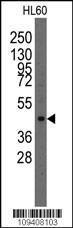 Anti-LMX1A Rabbit Polyclonal Antibody (PE (Phycoerythrin))