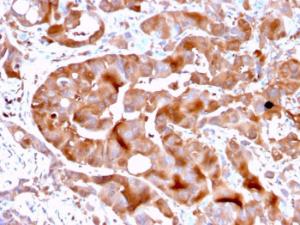 Immunohistochemical analysis of formalin-fixed, paraffin-embedded human liver tissue using Anti-FABP5 Antibody [FABP5/3750]