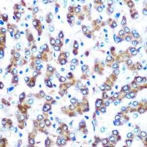 Immunohistochemistry analysis of paraffin-embedded human liver using Anti-COX2 Antibody [ARC0800] (A305988) at a dilution of 1:100 (40x lens). Perform microwave antigen retrieval with 10 mM PBS buffer pH 7.2 before commencing with IHC staining protocol.