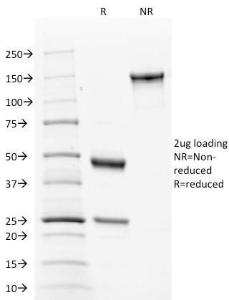 SDS-PAGE analysis of Anti-Calnexin Antibody [CANX/1543] under non-reduced and reduced conditions; showing intact IgG and intact heavy and light chains, respectively. SDS-PAGE analysis confirms the integrity and purity of the antibody