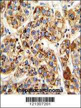 Anti-MCCC2 Rabbit Polyclonal Antibody