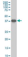 Anti-SPP1 Mouse Monoclonal Antibody [clone: 4E6]