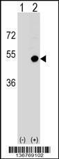 Anti-CD1D Rabbit Polyclonal Antibody (HRP (Horseradish Peroxidase))