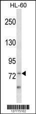 Anti-ZBTB39 Rabbit Polyclonal Antibody (FITC (Fluorescein Isothiocyanate))