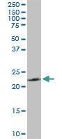 Anti-PGRMC2 Mouse Monoclonal Antibody [clone: 3C11]