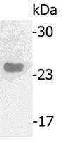 Western blotting using saliva