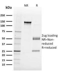 SDS-PAGE analysis of Anti-FABP5 Antibody [FABP5/3750] under non-reduced and reduced conditions; showing intact IgG and intact heavy and light chains, respectively. SDS-PAGE analysis confirms the integrity and purity of the antibody.