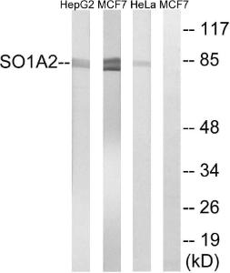 Western blot analysis of lysates from HeLa, MCF-7, and HepG2 cells using Anti-SLCO1A2 Antibody. The right hand lane represents a negative control, where the antibody is blocked by the immunising peptide.