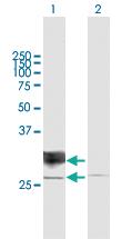 Anti-RND1 Mouse Polyclonal Antibody